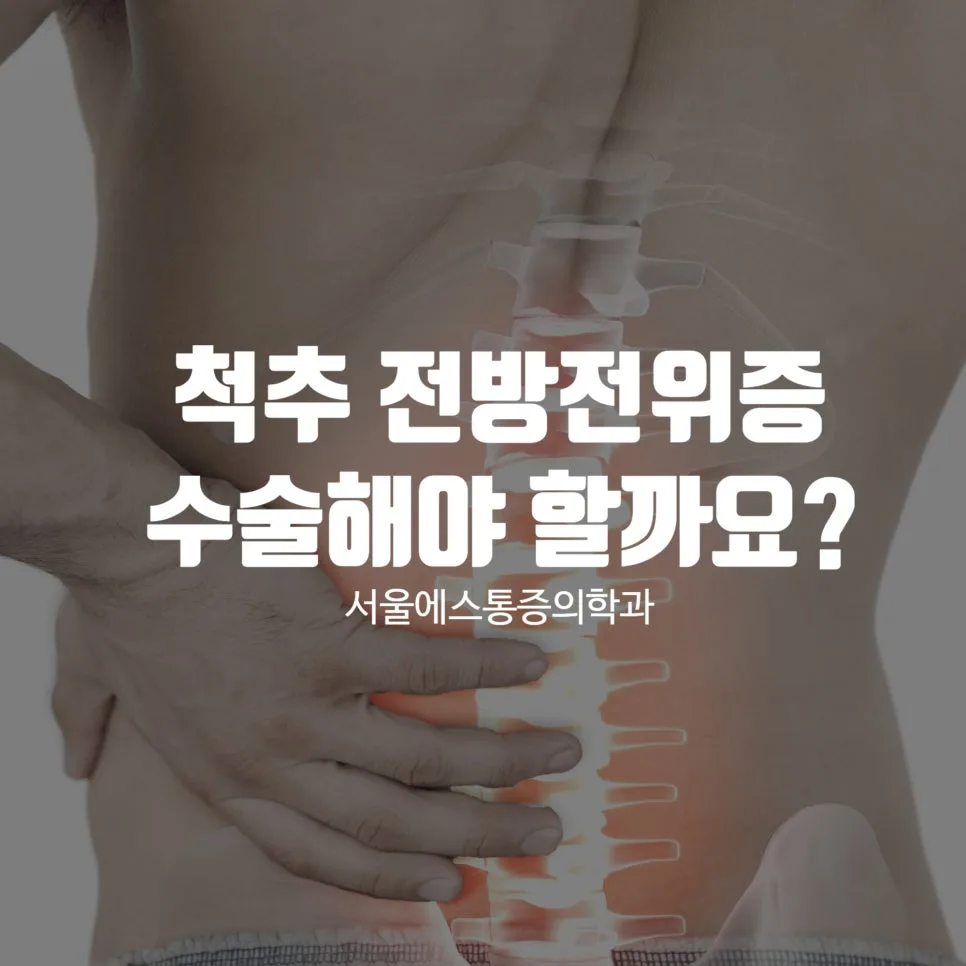 이수역 척추전방전위증, 증상과 비수술 치료 선택 기준 관련 사진 1