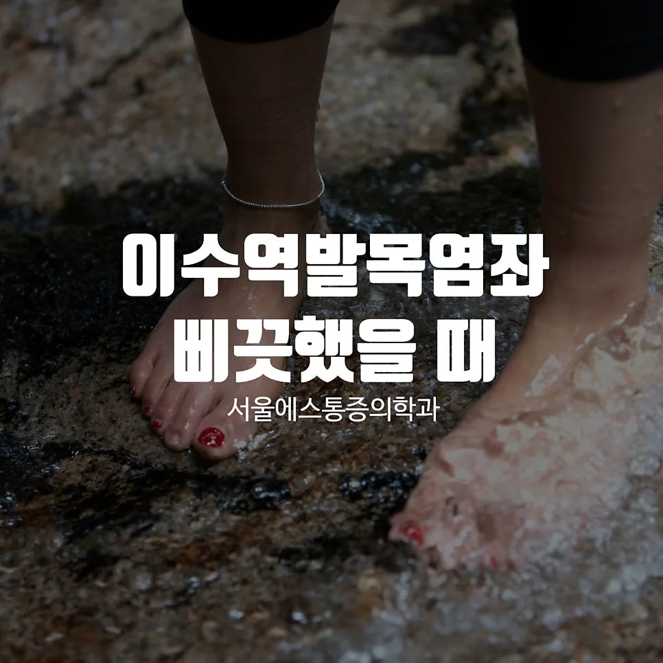 이수역 발목염좌, 삐끗한 뒤 초기 치료가 중요한 이유 관련 사진 1