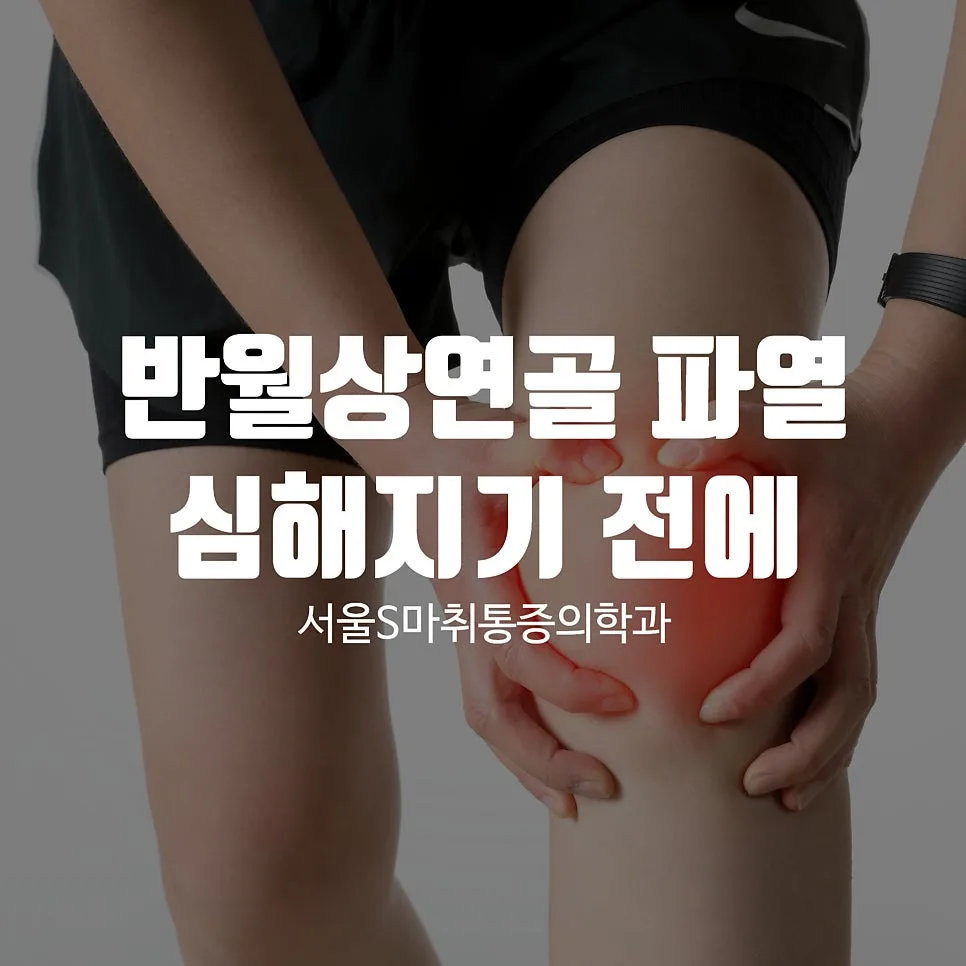 이수역 반월상연골파열, 증상과 치료·재활 과정 안내 관련 사진 1