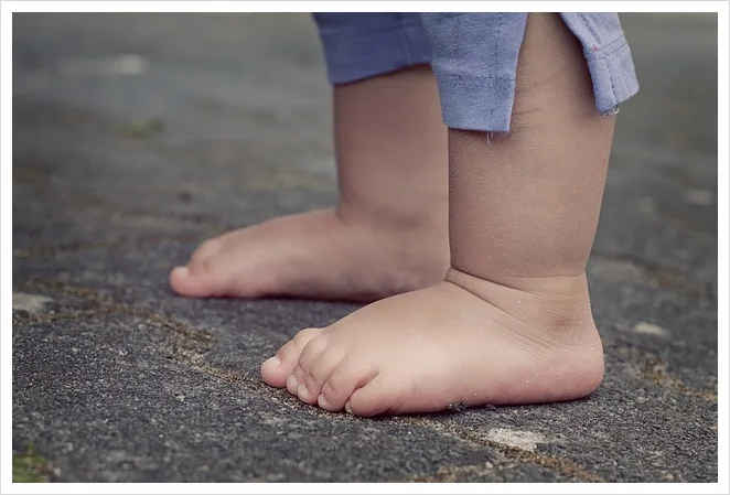 이수역 부주상골증후군, 발 안쪽 통증의 원인과 치료 관련 사진 2