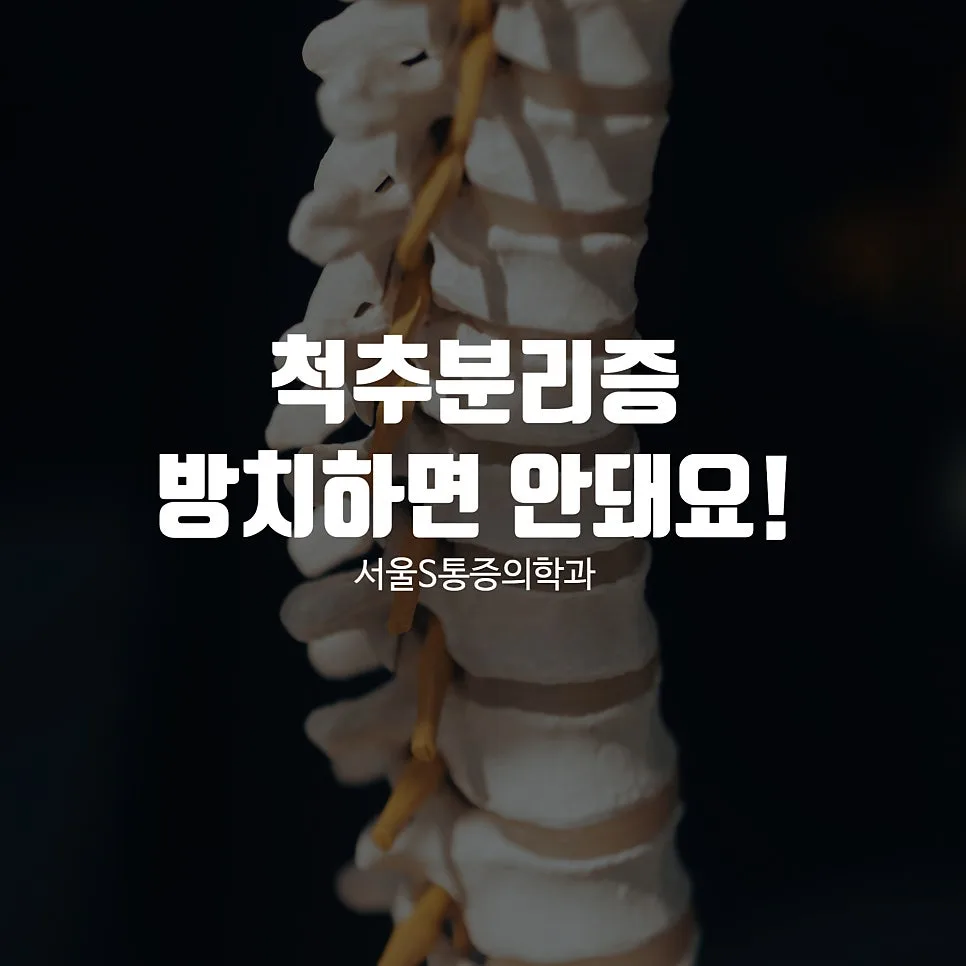 이수역 척추분리증, 요통의 원인과 진단·치료 방향 관련 사진 1