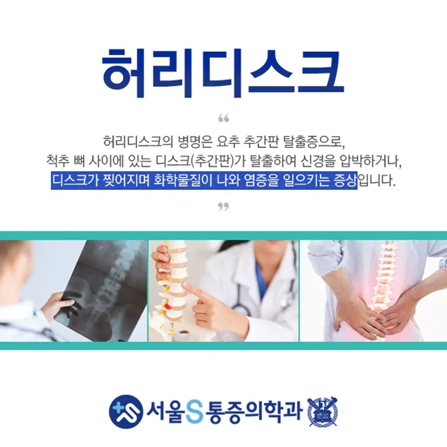 이수역 허리 통증, 주요 원인과 생활 속 예방 방법 관련 사진 1