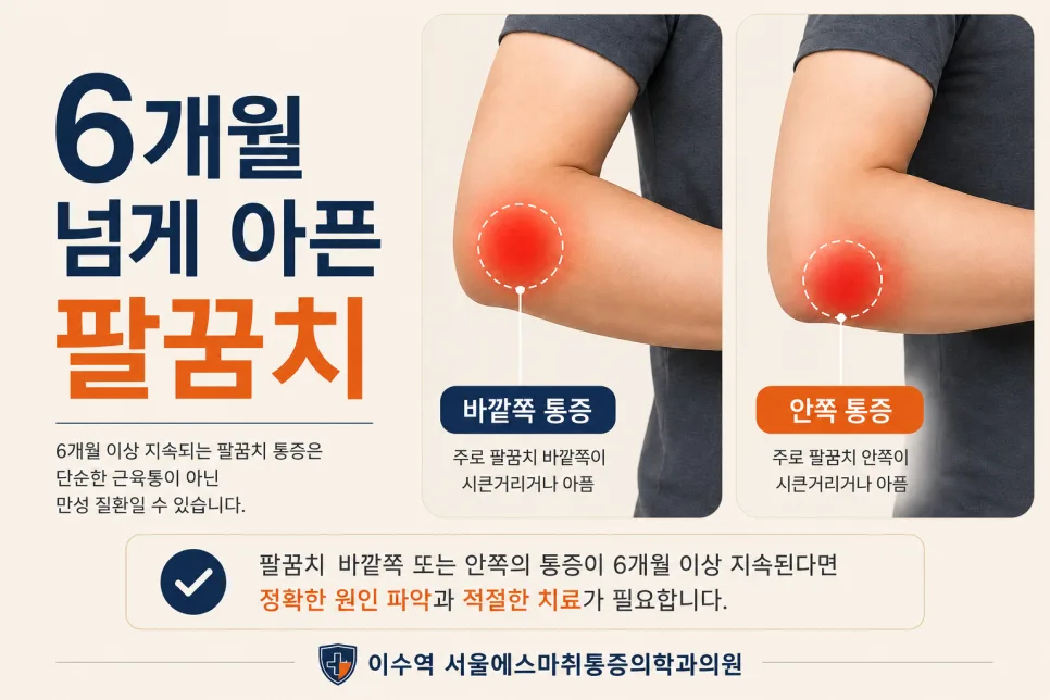 이수역 팔꿈치 통증이 6개월 넘게 이어질 때 확인할 것 관련 사진 1